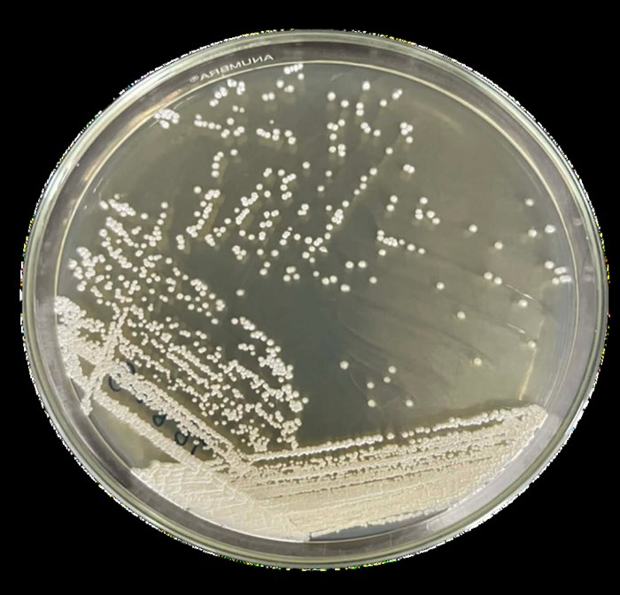 ลักษณะเชื้อ Streptomyces araujoniae เจริญบนอาหารเลี้ยงเชื้อ